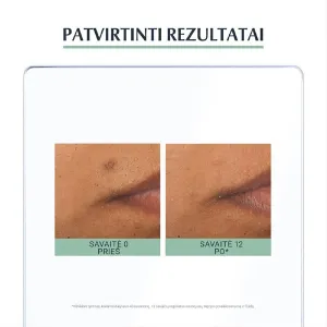 EUCERIN DermoPure trejopo poveikio serumas 40ml