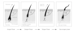 LABO HAIR LOSS 5 Patents ampulės stabdančios plaukų slinkimą VYRAMS 14 amp. (1 mėn. kursas)